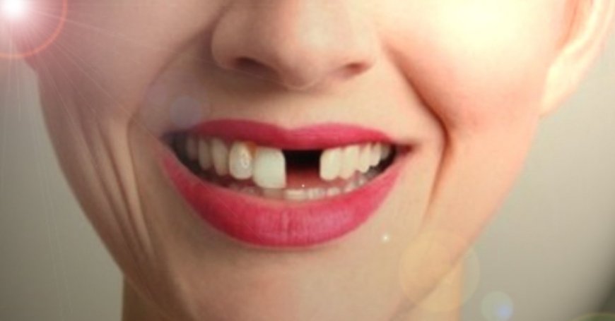 Rüyada Diş Dökülmesi: Kontrol Kaybı, Geçiş ve Yaşlanma Korkusu